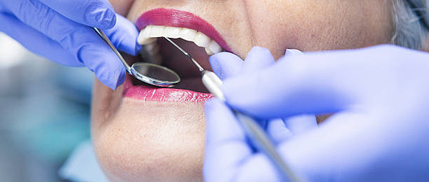 Best Chipped Tooth Repair Near Me  in Mount Joy, PA